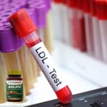 Manfaat Biolipid untuk Mengendalikan LDL dan Meningkatkan Kesehatan Jantung